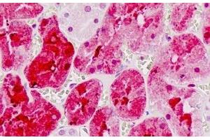 Human Kidney, Tubules: Formalin-Fixed, Paraffin-Embedded (FFPE)