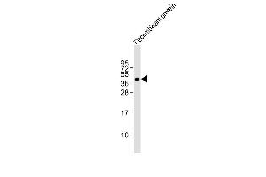 FAT4 recombinant protein at 20 µg per lane, probed with bsm-51360M FAT4 (1654CT645. (FAT4 抗体)