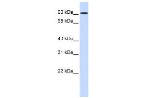 HSPH1 antibody used at 1 ug/ml to detect target protein. (HSPH1 抗体  (Middle Region))