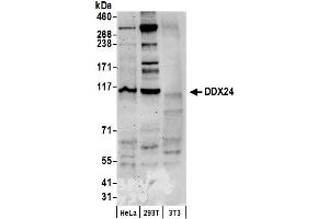 anti-DEAD (Asp-Glu-Ala-Asp) Box Polypeptide 24 (DDX24) (AA 325-375) antibody