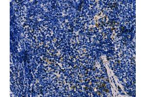 ABIN6266100 and ABIN6278545 at 1/100 staining mouse spleen tissue by IHC-P.