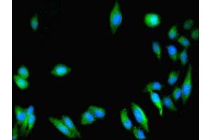 Immunofluorescent analysis of Hela cells using ABIN7154769 at dilution of 1:100 and Alexa Fluor 488-congugated AffiniPure Goat Anti-Rabbit IgG(H+L) (GUCY1A1 抗体  (AA 20-152))