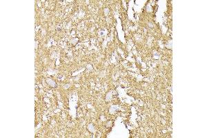 Immunohistochemistry of paraffin-embedded human brain using Synaptophysin Rabbit pAb (ABIN6135349, ABIN6148783, ABIN6148784 and ABIN6221958) at dilution of 1:200 (40x lens). (Synaptophysin 抗体  (AA 150-250))