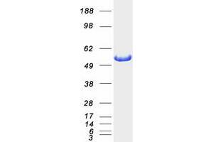 Aldehyde Dehydrogenase 7 Family, Member A1 (ALDH7A1) protein (Myc-DYKDDDDK Tag)