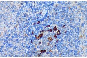 Immunohistochemistry (Paraffin-embedded Sections) (IHC (p)) image for anti-Peptidyl Arginine Deiminase, Type IV (PADI4) antibody (ABIN7258978)