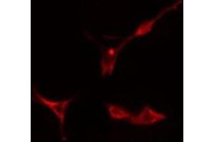 ABIN6275895 staining  Hela cells by IF/ICC. (MCPH1 抗体  (N-Term))