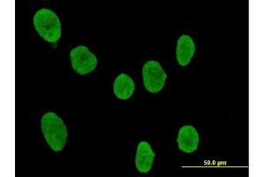 Immunofluorescence of purified MaxPab antibody to SOCS4 on HeLa cell. (SOCS4 抗体  (AA 1-440))