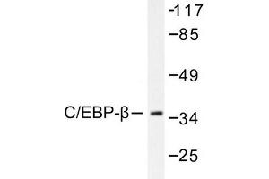 Image no. 1 for anti-CCAAT/enhancer Binding Protein (C/EBP), beta (CEBPB) antibody (ABIN265332) (CEBPB 抗体)