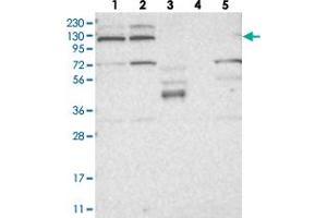 Western blot analysis of Lane 1: RT-4, Lane 2: U-251 MG, Lane 3: Human Plasma, Lane 4: Liver, Lane 5: Tonsil with KIF4A polyclonal antibody  at 1:250-1:500 dilution. (KIF4A 抗体)