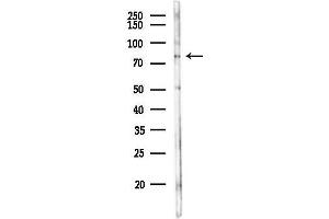 Western blot analysis of lysates from HepG2 cells(heat-shock,45 min treatment), using FBXL5 Antibody at 1/1000 dilution.