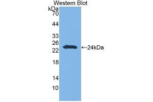 Western blot analysis of the recombinant protein. (CNTNAP4 抗体  (AA 706-886))