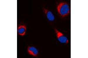 Immunofluorescent analysis of Beta-tubulin staining in Jurkat cells. (TUBB 抗体  (C-Term))