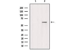 Western blot analysis of extracts from Mouse spleen, using RABEP2 Antibody. (RABEP2 抗体  (Internal Region))