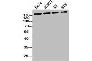 Western Blot analysis of HELA 22RV1 KB NIH-3T3 cells using Phospho-IRS-1 (S636) Polyclonal Antibody