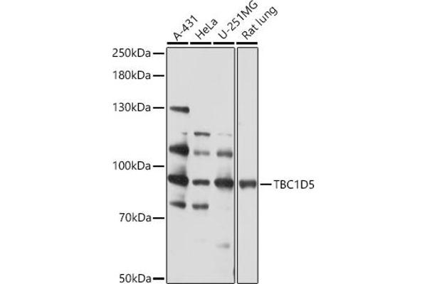 TBC1D5 anticorps  (AA 446-795)