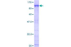 Image no. 1 for erythrocyte Membrane Protein Band 4.1-Like 2 (EPB41L2) (AA 1-633) protein (GST tag) (ABIN1352882) (EPB41L2 Protein (AA 1-633) (GST tag))