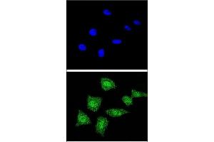Confocal immunofluorescent analysis of SOD1 Antibody (Center) (ABIN652681 and ABIN2842453) with 293 cell followed by Alexa Fluor® 488-conjugated goat anti-rabbit lgG (green). (SOD1 抗体  (AA 55-84))