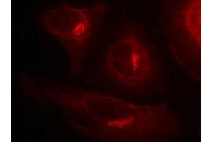 Immunofluorescence staining of methanol-fixed Hela cells showing cytoplasmic staining using GSK3a(Phospho-Ser21) Antibody.