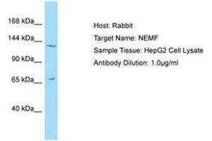 Image no. 1 for anti-serologically Defined Colon Cancer Antigen 1 (SDCCAG1) (C-Term) antibody (ABIN6750217)