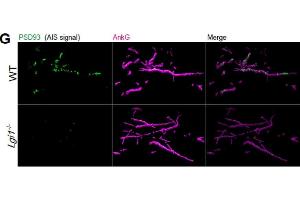 anti-Discs, Large Homolog 2 (DLG2) (AA 1-852) antibody