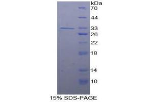 SDS-PAGE analysis of Human Smad5 Protein.