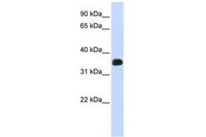 Image no. 1 for anti-Chromosome 2 Open Reading Frame 47 (C2orf47) (C-Term) antibody (ABIN6740965) (C2orf47 抗体  (C-Term))