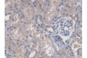 DAB staining on IHC-P; Samples: Human Kidney Tissue (CBY1/PGEA1 抗体  (AA 12-115))