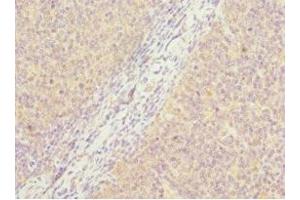 Immunohistochemistry of paraffin-embedded human tonsil tissue using ABIN7162885 at dilution of 1:100 (PCM1 抗体  (AA 1-260))