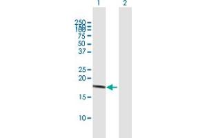 Western Blot analysis of IL10 expression in transfected 293T cell line by IL10 MaxPab polyclonal antibody. (IL-10 抗体  (AA 1-178))