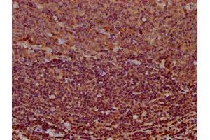 Immunohistochemistry (IHC) image for anti-Membrane-Spanning 4-Domains, Subfamily A, Member 2 (Fc Fragment of IgE, High Affinity I, Receptor For, beta Polypeptide) (MS4A2) (AA 1-59) antibody (ABIN7155184)