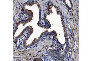 IHC analysis of Liver Carboxylesterase 1/CES1 using anti-Liver Carboxylesterase 1/CES1 antibody (ABIN7602719).