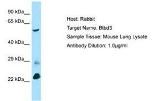 Image no. 1 for anti-BTB (POZ) Domain Containing 3 (BTBD3) (AA 367-416) antibody (ABIN6749832) (BTBD3 抗体  (AA 367-416))