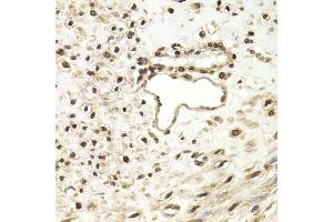 Immunohistochemistry of paraffin-embedded human leiomyoma of uterus using FKBP4 Antibody (ABIN5973289) at dilution of 1/200 (40x lens). (FKBP4 抗体)