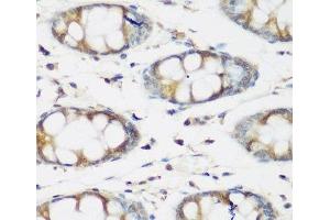 Immunohistochemistry of paraffin-embedded Human colon using BMP2 Polyclonal Antibody at dilution of 1:200 (40x lens). (BMP2 抗体)