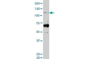 HIPK2 monoclonal antibody (M06), clone 4E3. (HIPK2 抗体  (AA 961-1065))