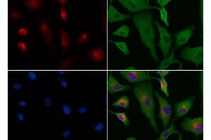 ABIN6264533 and ABIN6276573 staining HUVEC cells by IF/ICC.