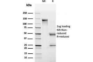 SDS-PAGE Analysis Purified HLA-Pan Mouse Monoclonal Antibody (CR3/43). (MHC Class II HLA-DP/DQ/DR 抗体)