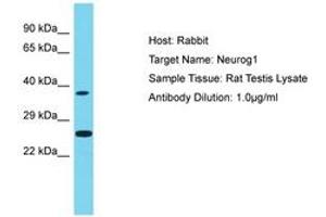 Image no. 1 for anti-Neurogenin 1 (NEUROG1) (AA 51-100) antibody (ABIN6750261) (Neurogenin 1 抗体  (AA 51-100))