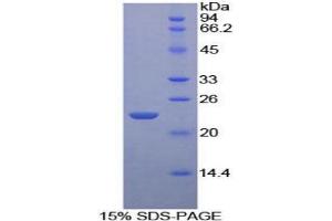 SDS-PAGE analysis of Mouse Iga Protein. (CD79a 蛋白)