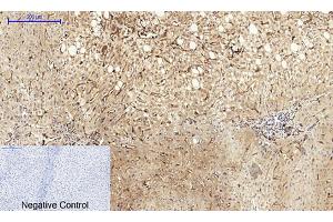 Immunohistochemical analysis of paraffin-embedded human liver tissue. (Caveolin-1 抗体  (AA 100-180))