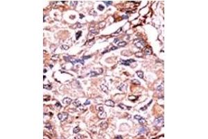 Image no. 2 for anti-SMAD, Mothers Against DPP Homolog 3 (SMAD3) (pSer213) antibody (ABIN358226) (SMAD3 抗体  (pSer213))
