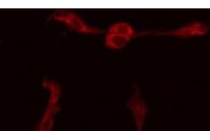 ABIN6277217 staining HepG2 by IF/ICC. (BIK 抗体  (N-Term))