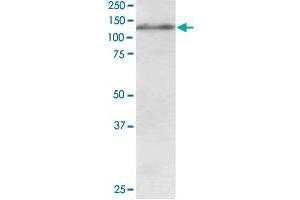 USP11 polyclonal antibody  staining (1 ug/mL) of Jurkat lysate (RIPA buffer, 30 ug total protein per lane). (USP11 抗体)