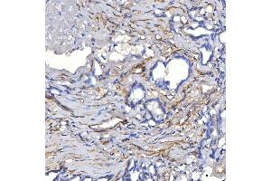 IHC analysis of TP53I13 using anti-TP53I13 antibody (ABIN7601220). (TP53I13 抗体  (AA 30-365))