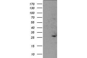 Western Blotting (WB) image for anti-Suppressor of Cytokine Signaling 3 (SOCS3) antibody (ABIN1501060) (SOCS3 抗体)