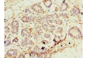 Immunohistochemistry of paraffin-embedded human breast cancer using ABIN7164746 at dilution of 1:100 (PA2G4 抗体  (AA 2-394))