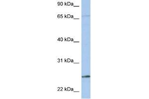 WB Suggested Anti-KLK6 Antibody Titration:  0. (Kallikrein 6 抗体  (N-Term))