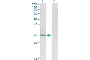 Western Blot analysis of TGIF2 expression in transfected 293T cell line by TGIF2 monoclonal antibody (M15A), clone 2A4. (TGIF2 抗体  (AA 1-237))