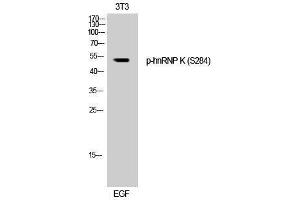 Western Blotting (WB) image for anti-Heterogeneous Nuclear Ribonucleoprotein K (HNRNPK) (pSer284) antibody (ABIN3182264) (HNRNPK 抗体  (pSer284))