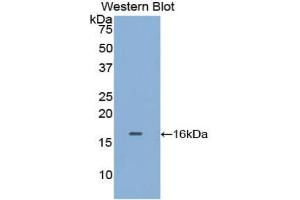 Western blot analysis of the recombinant protein. (TPSAB1 抗体  (AA 29-148))